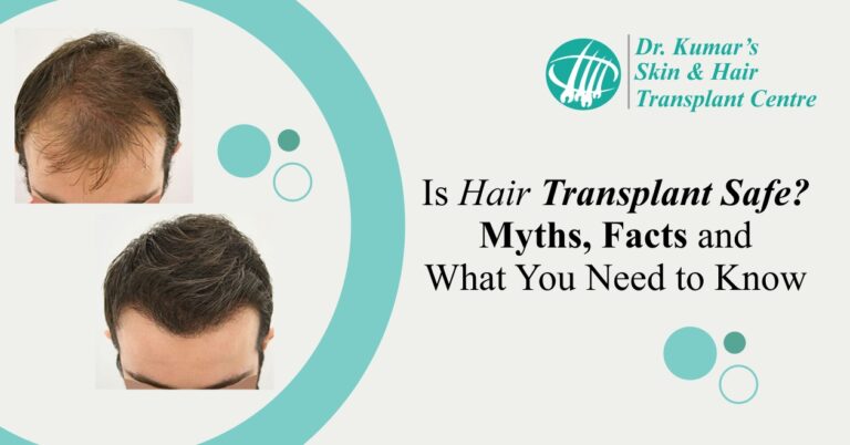 Is Hair Transplant Safe Myths, Facts and What You Need to Know