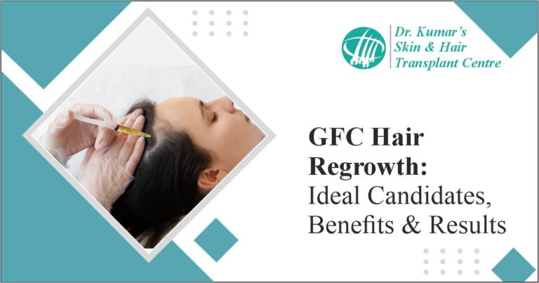 GFC Hair Regrowth Ideal Candidates, Benefits & Results