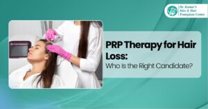 PRP Therapy for Hair Loss Who Is the Right Candidate