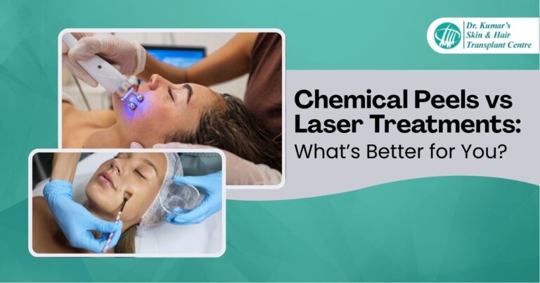 Chemical Peels vs Laser Treatments What’s better for you