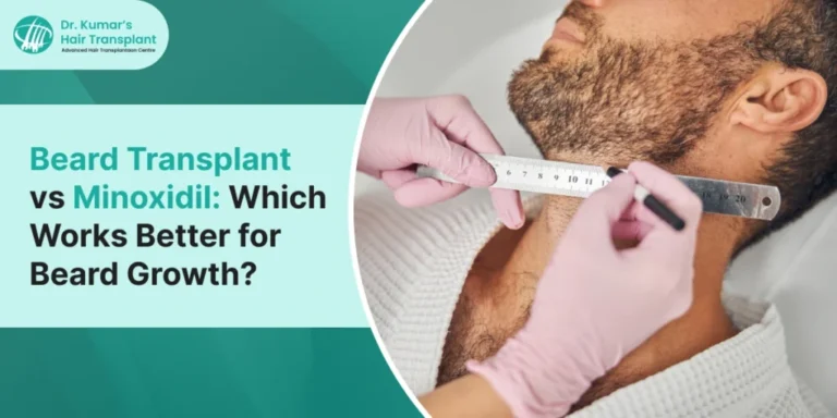 Beard Transplant vs Minoxidil Which Works Better for Beard Growth