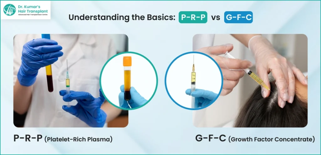 Understanding-the-Basics_-P-R-P-vs-G-F-C-