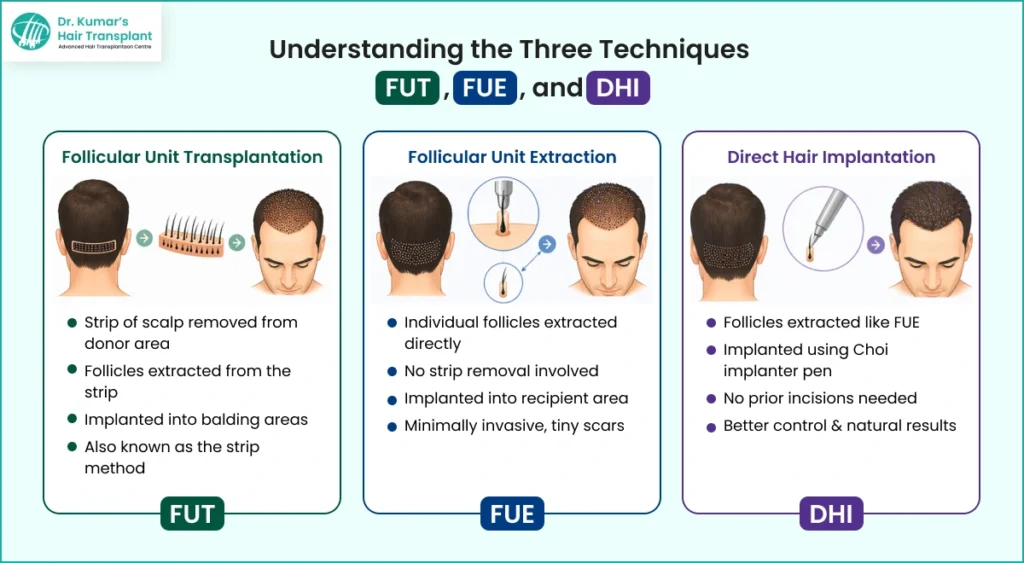 Understanding the Three Techniques – FUT, FUE, and DHI