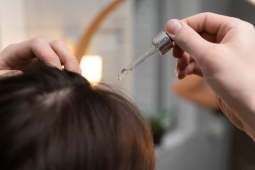 Human-Derived Exosomes Hair Treatment in Kondapur