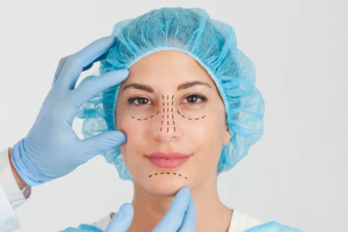 Thread Lift Treatment In Kondapur