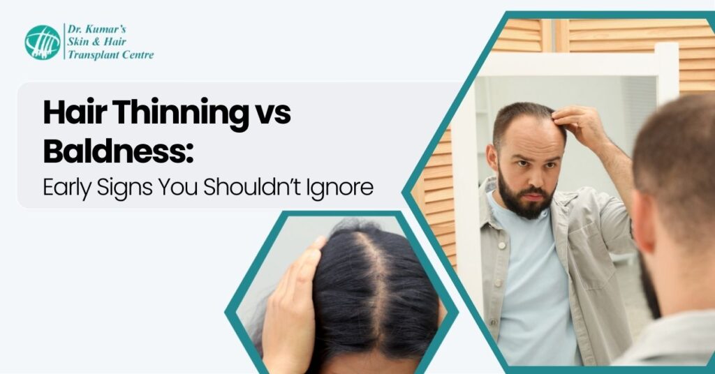 Hair Thinning vs Baldness: Early Signs You Shouldn’t Ignore