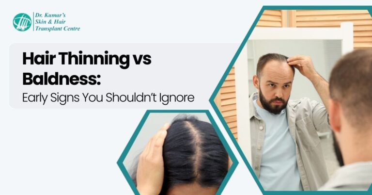 Hair Thinning vs Baldness: Early Signs You Shouldn’t Ignore